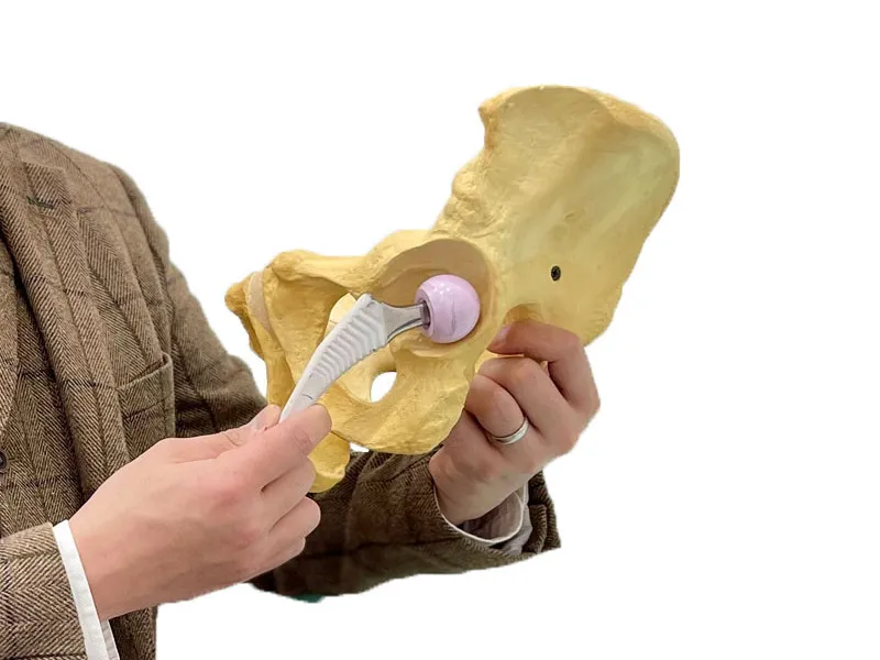 How MSK Doctors Can Help Deal With Osteoarthritis